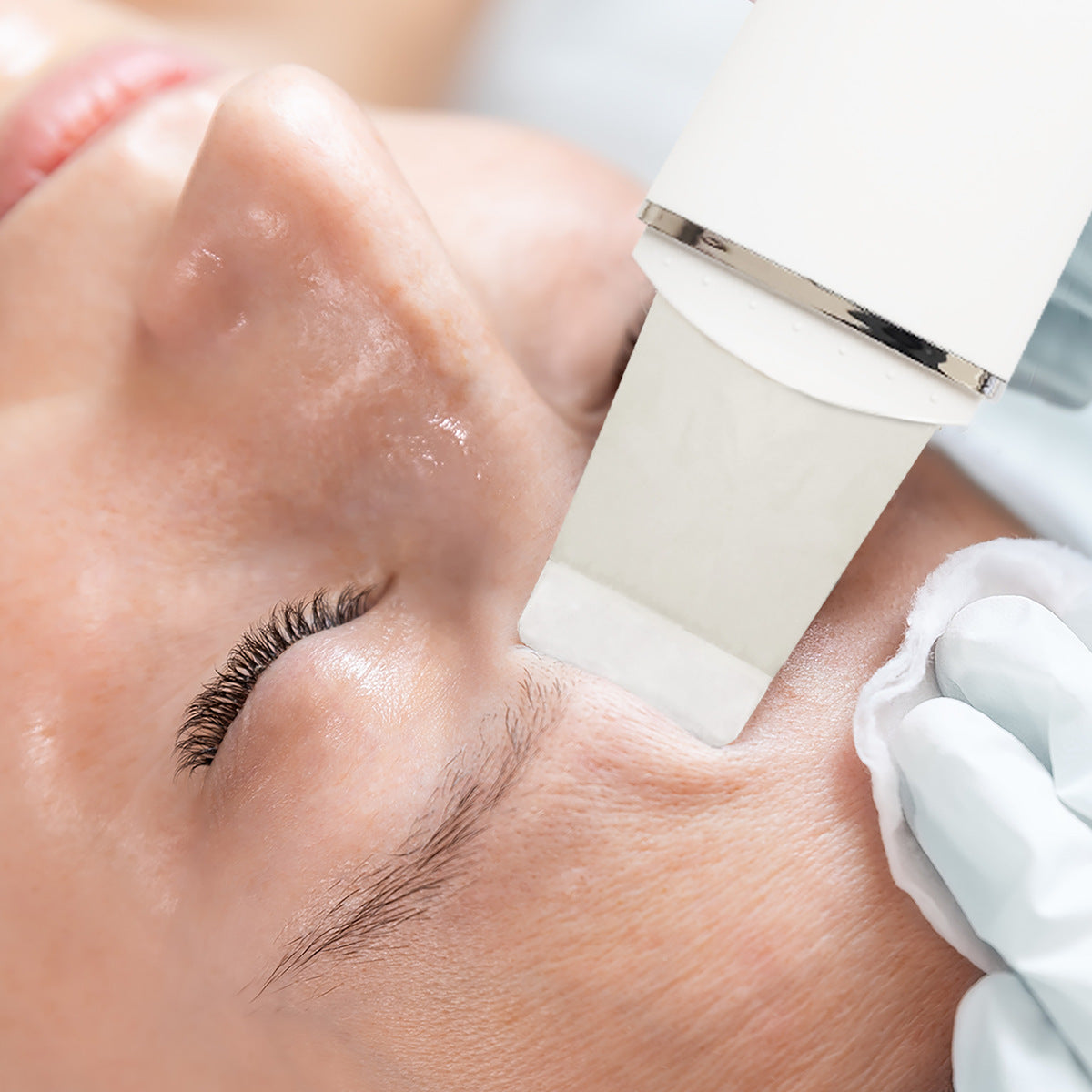 A close-up of a person with closed eyes receiving a forehead exfoliation using the Rio Ultrasonic Skin Cleanser, while a gloved hand supports their face.