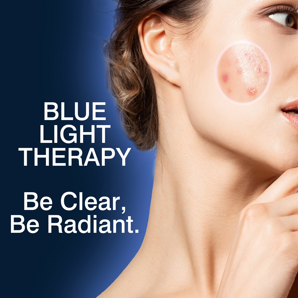 Close-up of a woman's face with acne on her cheek in a highlighted circle, promoting Rio LED Face Mask by Rio for blue light therapy and anti-ageing. Text: BLUE LIGHT THERAPY. Be Clear, Be Radiant. on a blue background.
