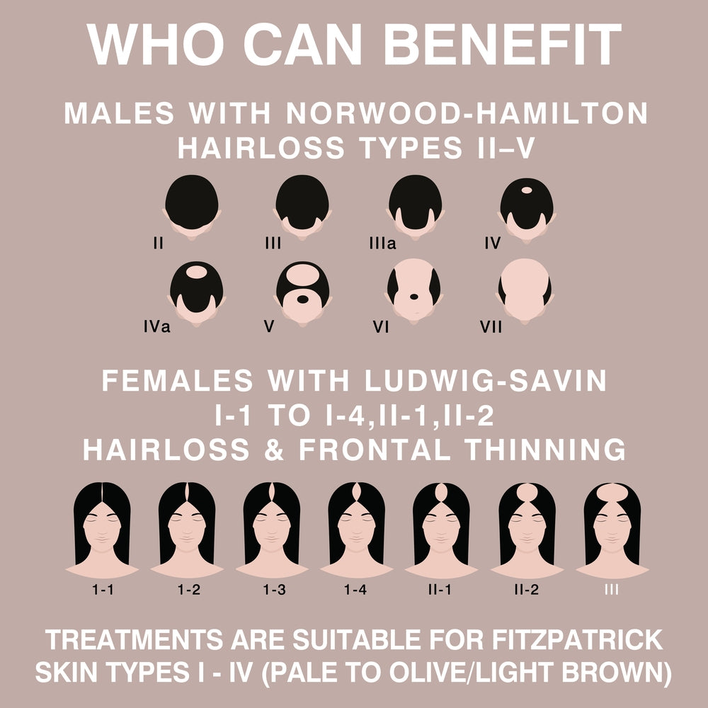 Infographic displays male (Norwood-Hamilton II–V) and female (Ludwig-Savin I-1 to III) hair loss patterns. Features Rio HairGrow Laser Head Band for hair regrowth using red light therapy on Fitzpatrick skin types I–IV.