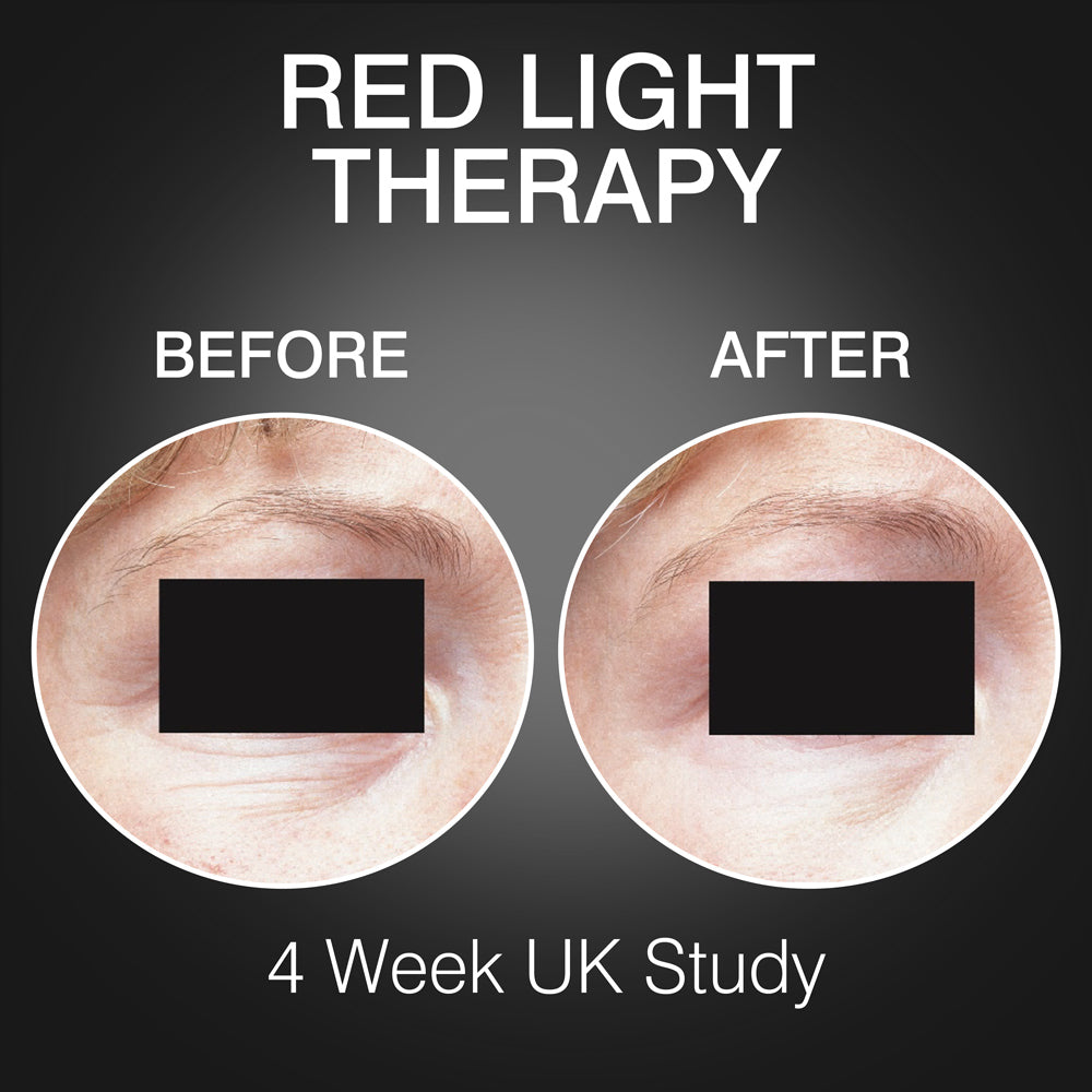 Before and after close-ups of eye-area skin show fewer wrinkles, with text: FaceGLO by Rio, RED LIGHT THERAPY, THREE Treatment Wavelengths, BEFORE, AFTER, 4-Week UK Study on a dark background.
