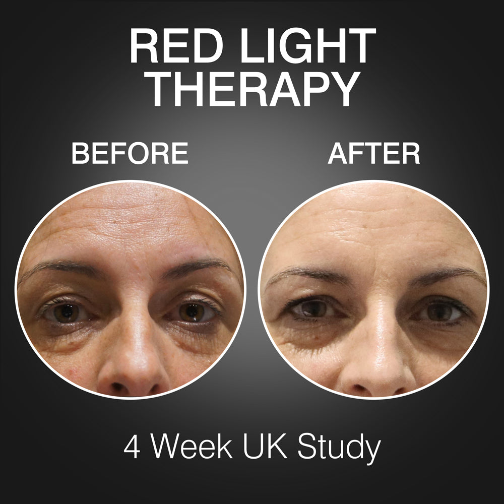 Close-up comparison of a woman's forehead and eye area before and after using Rio FaceGLO, showing smoother skin and fewer wrinkles after a 4-week UK study with three clinically effective treatment wavelengths. Text: Red Light Therapy, Before, After, 4-Week UK Study.