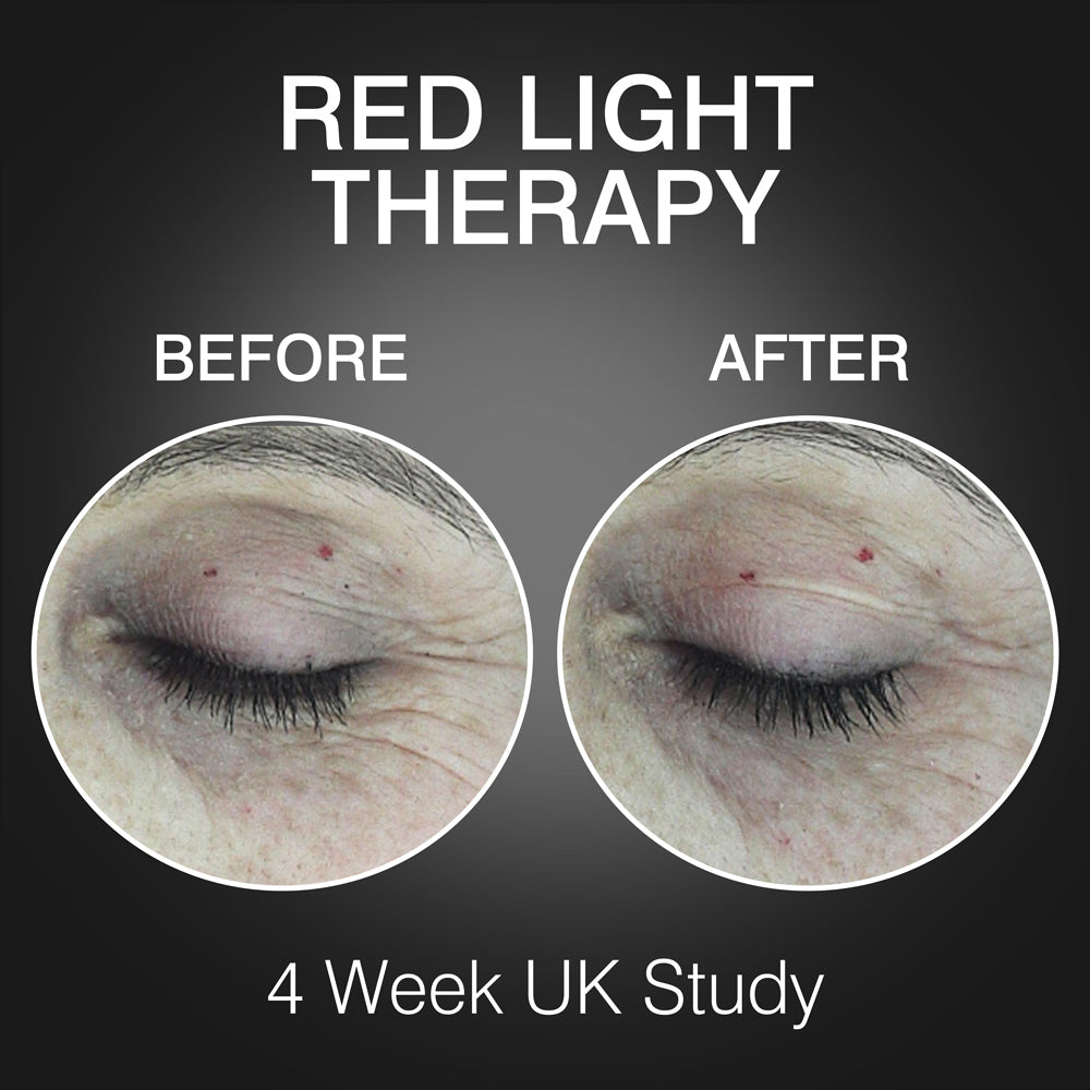 Close-up comparison of a closed eye before and after using Rio's FaceGLO with Photology Chlorophyll Light Masque shows fewer wrinkles and smoother skin after 4 weeks in a UK study. Text: Red Light Therapy, Before, After, 4-Week UK Study.
