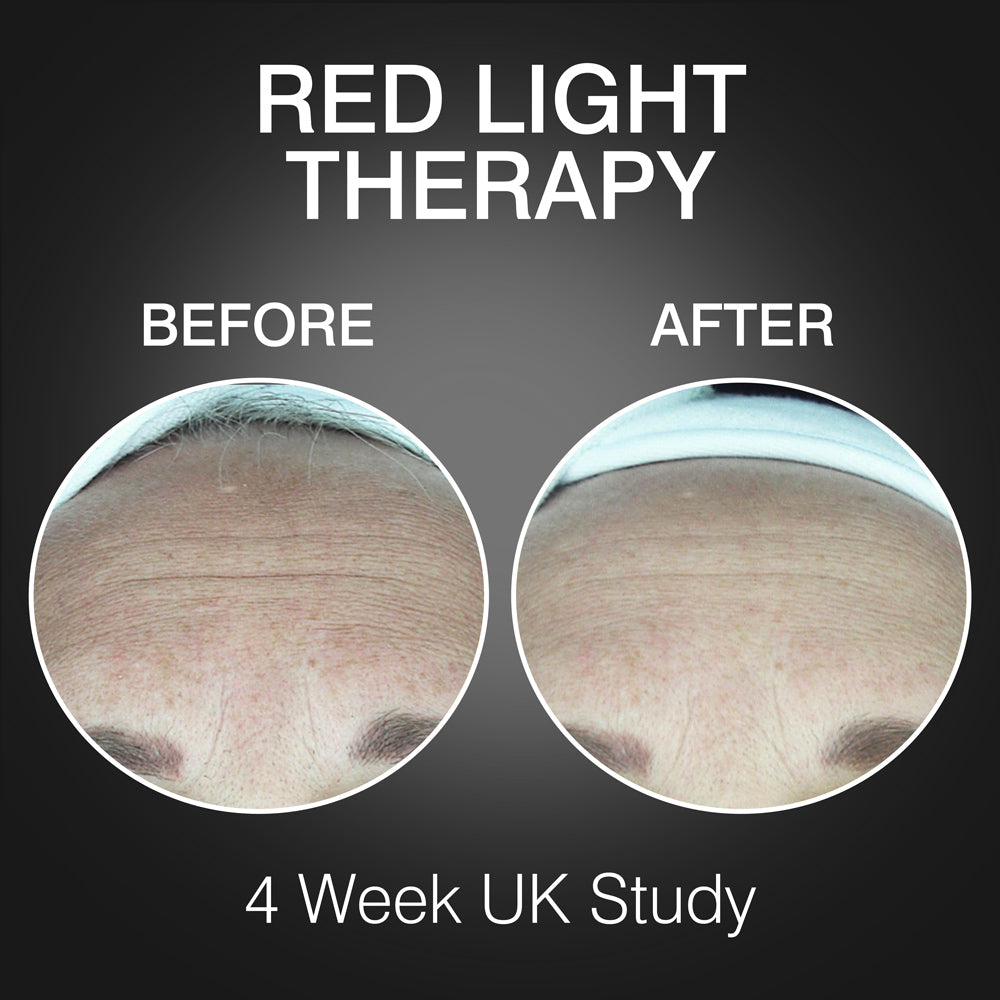 Before-and-after photos of a forehead with reduced wrinkles after 4 weeks using Rio FaceGLO mask with THREE Treatment Wavelengths. Text reads: RED LIGHT THERAPY, BEFORE, AFTER, and 4 Week UK Study.